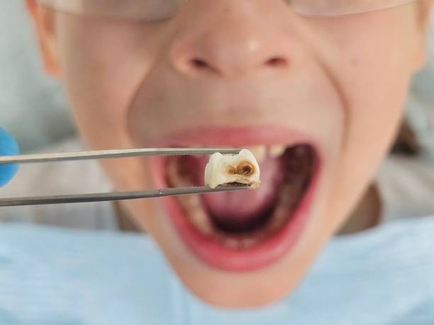 Best Emergency Care for Gum Disease in Pinehurst, NC